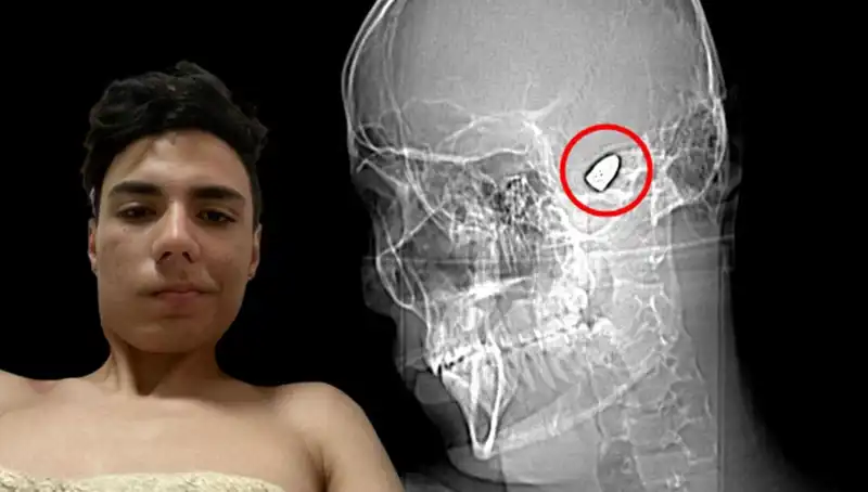 Kafasında Patlayıcı Var: Gözlerinizi Ayırmayacağınız Bir Hikaye