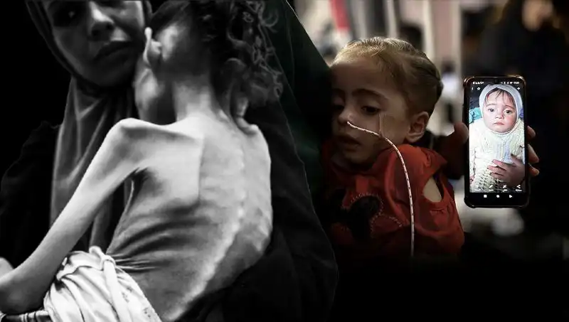 Küçük Meryem'in Dramı: 25 Kilodan 10 Kiloya Düşen Çocuk Açlıkla Mücadele Ediyor